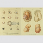 Chirurgische Kupfertafeln. 24 Hefte mit 121 Kupfertafeln, davon 14 farbig. 1824